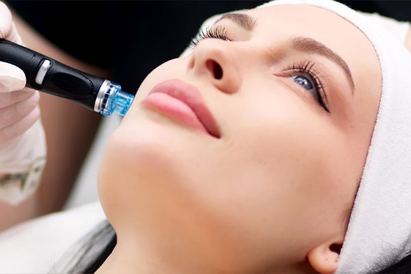 Micro-Needling